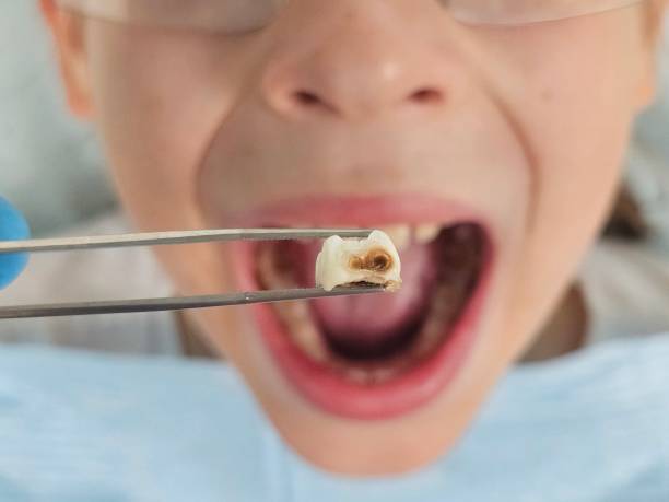  Louisiana, MO Emergency Dentist Pros